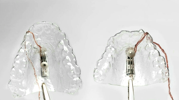 To introduce: [In]Brace by Dorothee Clasen in Cologne. Image by Dorothee Clasen.